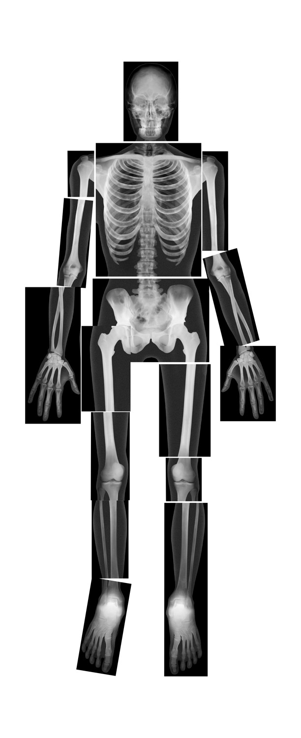 Röntgenbilder Röntgenbilder